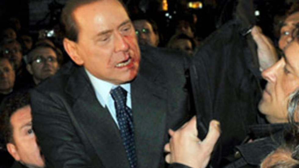 Blessé au visage, Berlusconi doit rester un jour de plus sous observation médicale