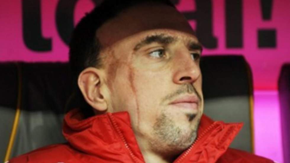 Une affaire de mœurs qui peut coûter cher à Ribéry ?