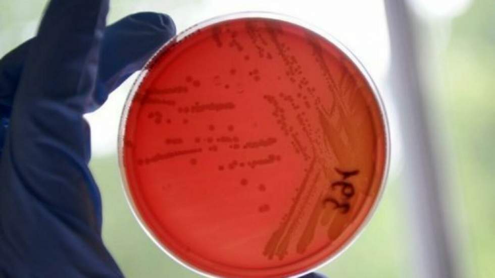 La bactérie E.coli provoque la mort d'une trentième personne