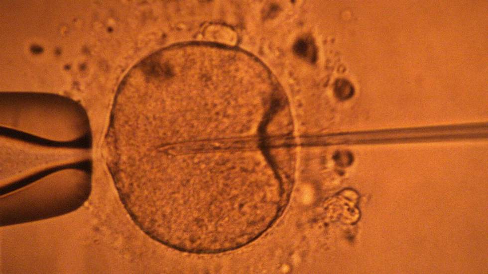 Londres autorise la conception de bébés à partir de trois ADN Londres autorise la conception de bébés à partir de trois ADN