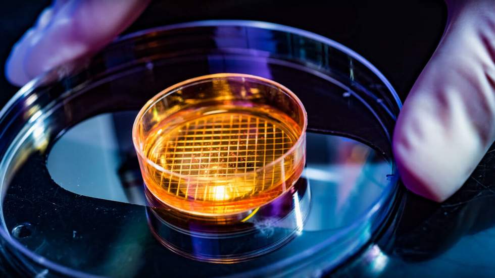 Des cellules créées en laboratoire laissent entrevoir la guérison des malades du diabète