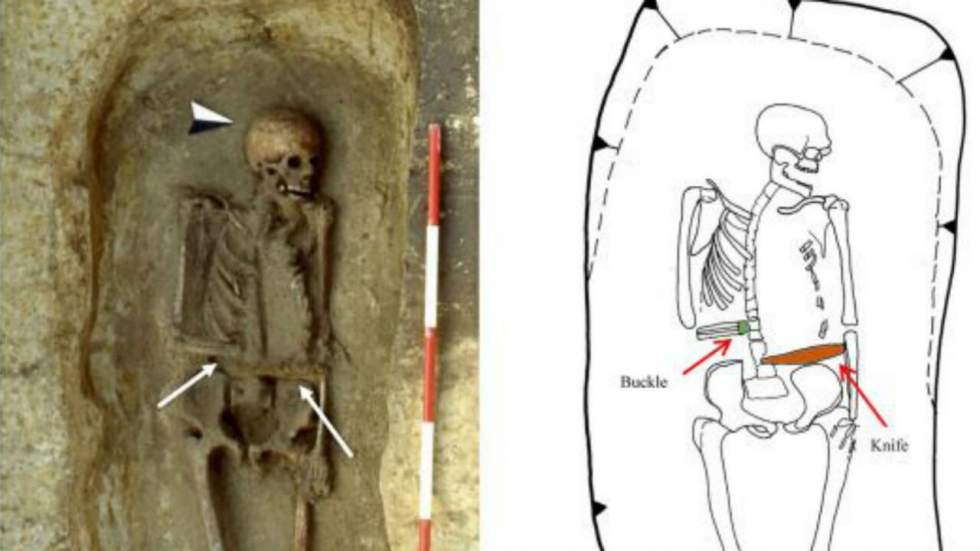 Ce guerrier du Moyen-Âge avait un couteau en guise de prothèse de l'avant-bras Ce guerrier du Moyen-Âge avait un couteau en guise de prothèse de l'avant-bras