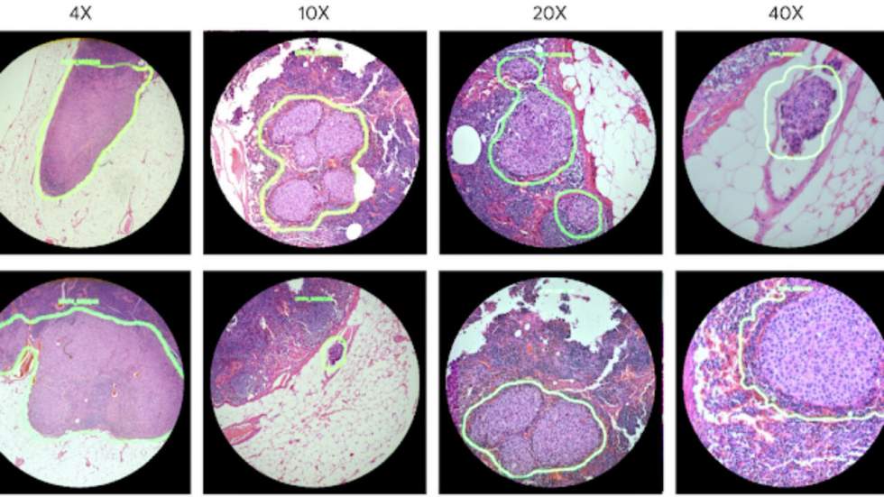 Un microscope Google en réalité augmentée pourrait aider à détecter instantanément un cancer