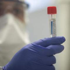 Coronavirus : l'appel de médecins français à un dépistage massif Coronavirus : l'appel de médecins français à un dépistage massif
