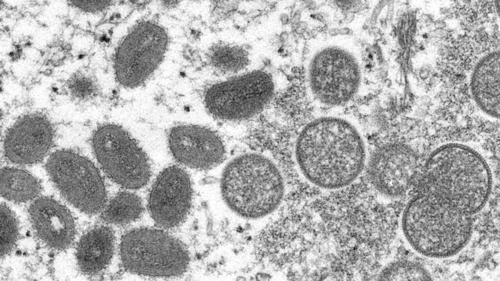 Pourquoi la propagation de la variole du singe dans le monde surprend Pourquoi la propagation de la variole du singe dans le monde surprend