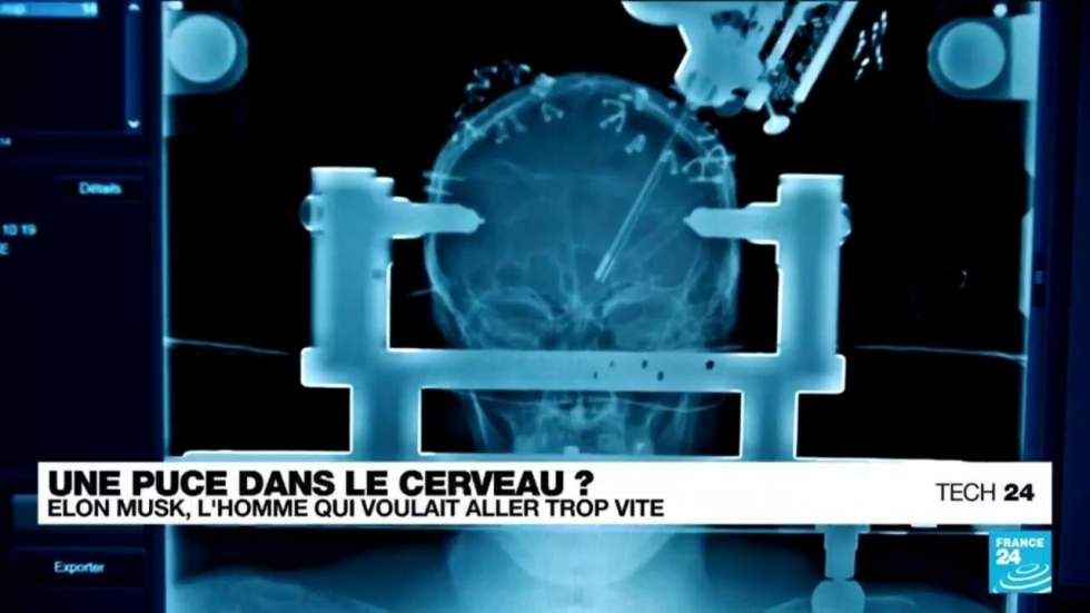 Projets d'implantation de puces dans le cerveau : ce qu'il faut savoir