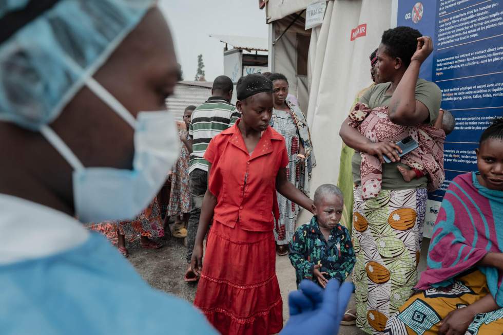 Mpox : la RD Congo espère recevoir les premières doses de vaccins la semaine prochaine