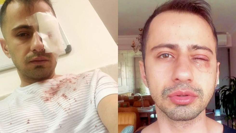 Iran : deux ans après la mort de Mahsa Amini, une "révolution culturelle" est en marche