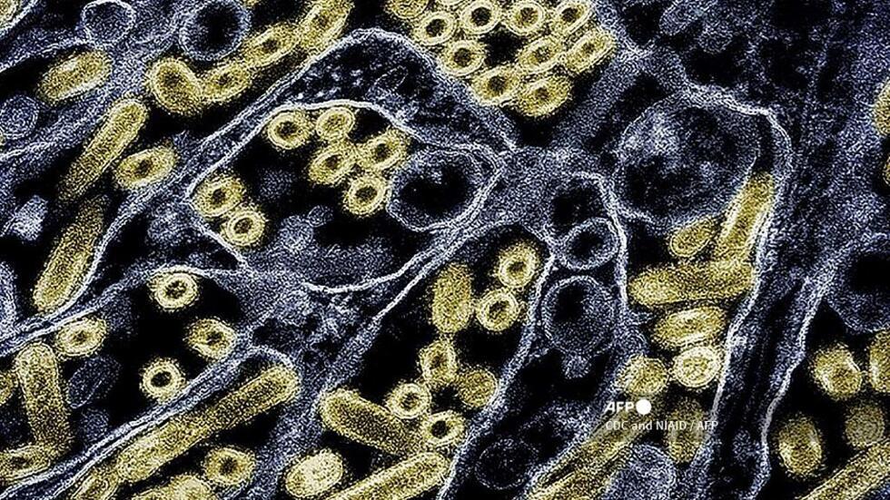 Virus H5N1 : le patient "mystère" du Missouri ouvre-t-il la porte à une transmission entre humains ? Virus H5N1 : le patient "mystère" du Missouri ouvre-t-il la porte à une transmission entre humains ?