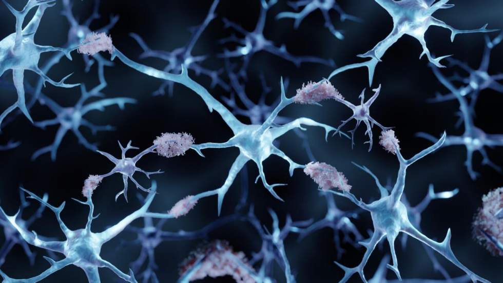 Pourquoi le lithium suscite de nouveaux espoirs face à la maladie d’Alzheimer ? Pourquoi le lithium suscite de nouveaux espoirs face à la maladie d’Alzheimer ?