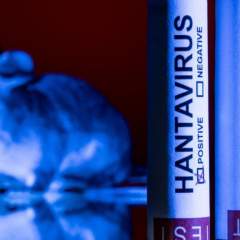 "Des raisons de ne pas être trop inquiet" : ce que l'on sait sur l'hantavirus Andes