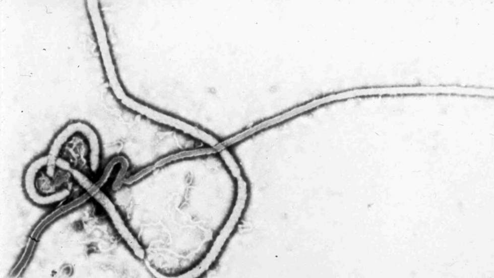 Virus Ebola : premier cas détecté en France chez un médecin de retour de RD Congo