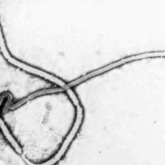 Virus Ebola : premier cas détecté en France chez un médecin de retour de RD Congo