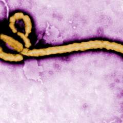 Virus Ebola : le premier cas identifié en France est "guéri"